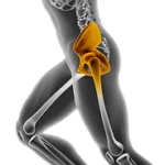 Direct Superior Approach