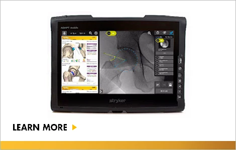 HipMap and HipCheck
Patient specific planning