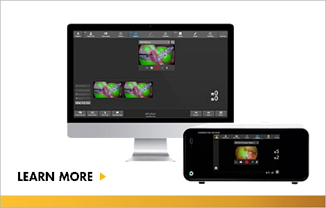 Connected OR
Integrated system